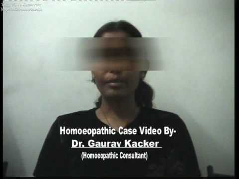 Best Homoeopathic Case Video.......Schizoaffective Disorder...Must Watch