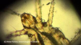 preview picture of video 'Under Microscope x 200: Terrible Grain Itchy Mite Pediculoides ventricosus on Honeybees'