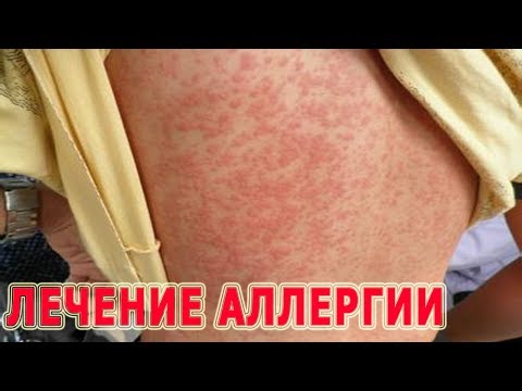 Die Behandlung narodnimi von den Mitteln gribka der Nägel Eksoderil der Preis in der Apotheke oserkach