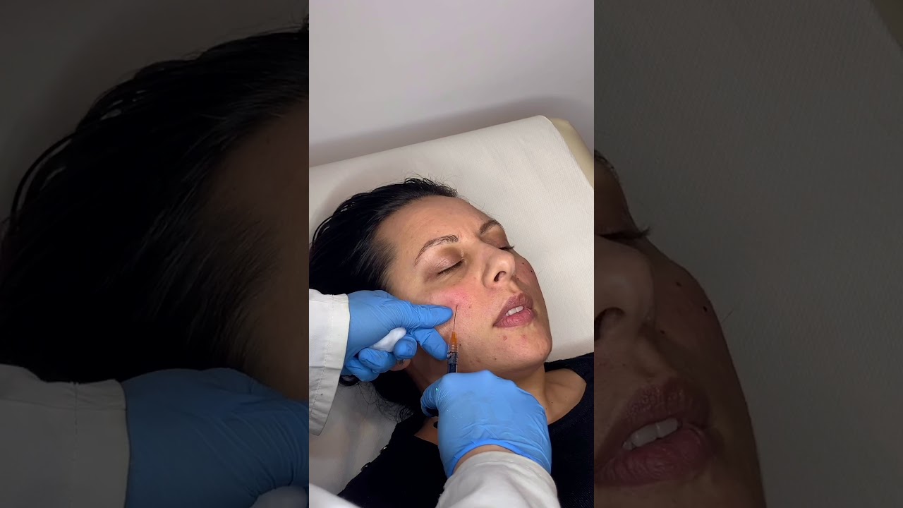 Piergiorgio Turco-32