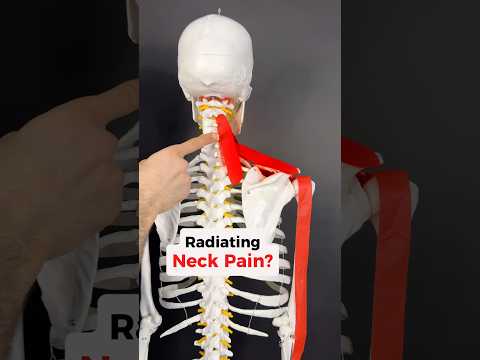Radiating Neck Pain? Fix the Muscles under it all! #scalenes #neckpain #shoulderpain #armpain #neck