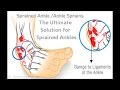 The Ultimate Solution for Sprained Ankles