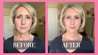 How to Get Rid of Neck Lines & Jowls Without Surgery or Fillers