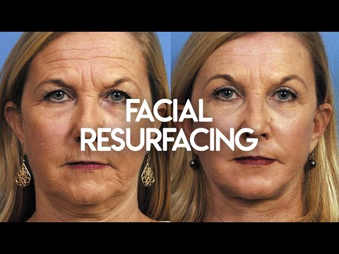 Facial Resurfacing