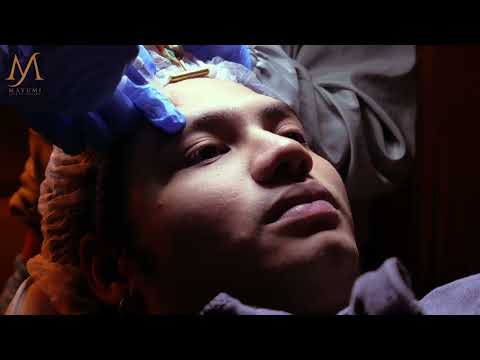 Hashtag Kid Yambao tries Mayumi Premium Hifu and Botox | MAYUMI BEAUTY CENTRE