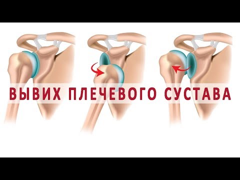 Лечение пиявками позвоночника видео Болят суставы из за уреаплазмы