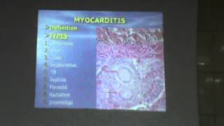27) Dr. Essam Ezzat 10-12-2015 [ Cardiomyopathy-Myocarditis-Pericarditis ]