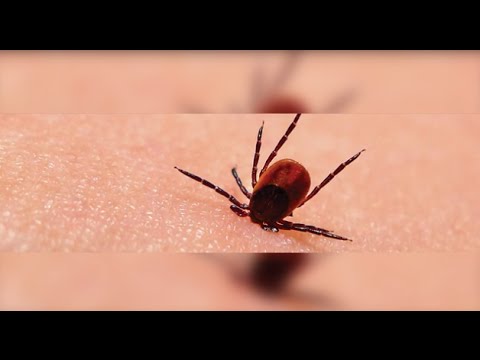 Lyme Disease | Chris’s Story