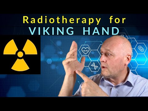 Radiotherapy for Dupuytren's Contracture / Viking Hand. The Pros and Cons.