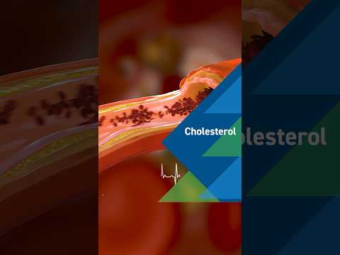 High Cholesterol Be Gone! … Medications Too!