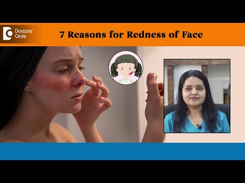7 Reasons for Redness of Face| Erythema, Sunburn, Rosacea - Dr. Urmila Nischal | Doctors' Circle