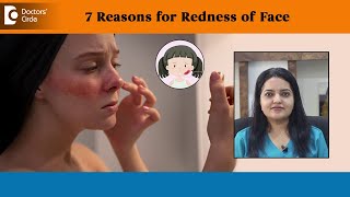7 Reasons for Redness of Face| Erythema, Sunburn, Rosacea - Dr. Urmila Nischal | Doctors