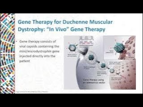 DMD and Gene Therapy What's On the Horizon
