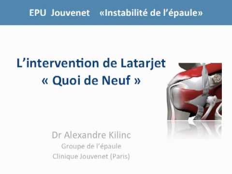 comment guerir une luxation de l'epaule