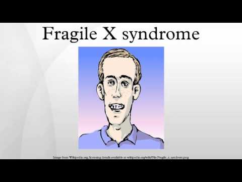 Fragile X syndrome