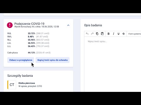 Sztuczna inteligencja (AI) w walce z COVID-19 dla badań TK (CT) płuc na Zbadani.pl