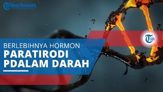 Hiperparatiroidisme, Kondisi di Mana Jumlah Hormon Paratiroid Berlebihan di Dalam Darah