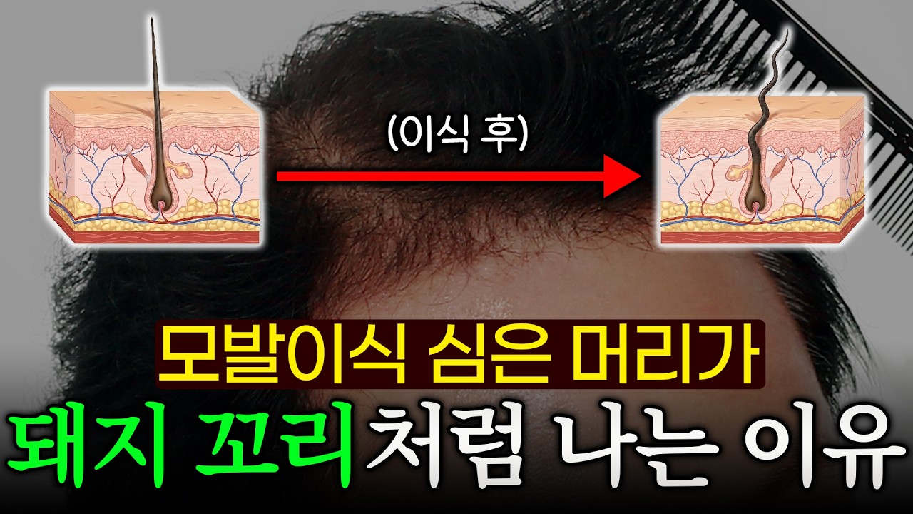 더원츠의원 유튜브