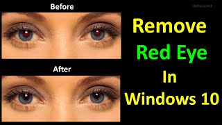 How to Remove Red Eye From Image In Windows 10