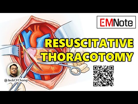 ED Resuscitative Thoracotomy