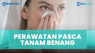 Perawatan yang Dilakukan setelah Melakukan Tanam Benang