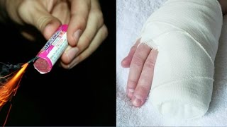 С какой стороны поджигать петарду
