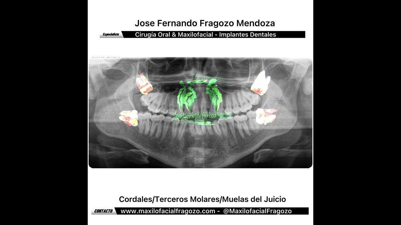 Jose Fernando Fragozo Mendoza-15