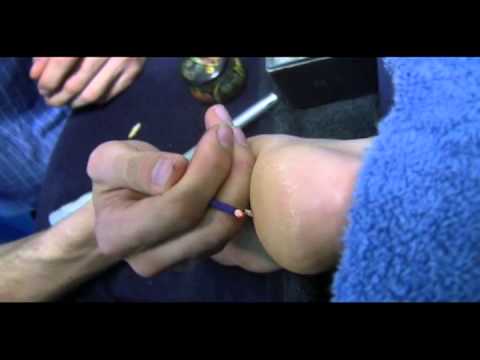 download lagu mp3 mp4 Japanese Moxibustion, download lagu Japanese Moxibustion gratis, unduh video klip Japanese Moxibustion