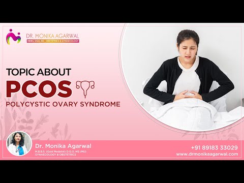 Dr. Monika Agarwal talks about Polycystic Ovary Syndrome (PCOS)