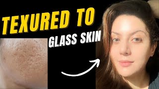 How to treat textured skin | Bumpy skin texture I Closed comedones treatment | Pitted scar treatment