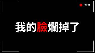 我的臉爛掉了...因為使用了廣告上的護膚品，