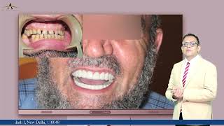 Implant Placement | Ark Dental Clinic | Crowns | Dental Treatment