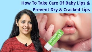 How To Take Care Of Baby Lips &amp; Prevent Dry &amp; Cracked Lips