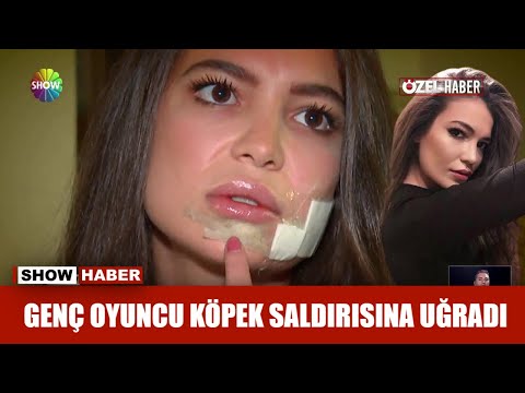 Genç oyuncu köpek saldırısına uğradı