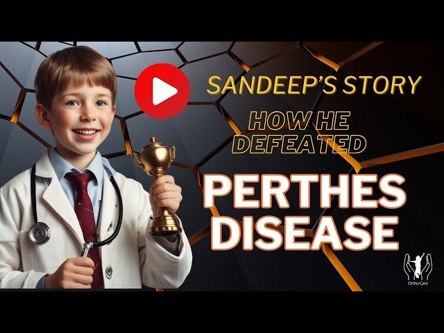 Perthes Disease Treatment