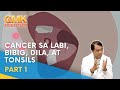 Cancer sa Labi, Bibig, Dila, at Tonsils (Part 1) | Usapang Pangkalusugan
