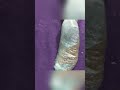 Heel peel treatment