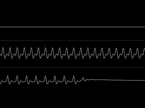 Wiklund - “Megamix” (C64) [Oscilloscope View]