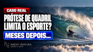 Esporte e prótese de quadril