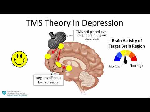 Transcranial Magnetic Stimulation: A New Treatment Approach for Psychiatric Disorders