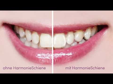 Hier wird Lächeln gemacht - HarmonieSchiene vom deutschen Fachlabor Orthos