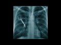 Machine Go Boom - Bumbling Medical Students