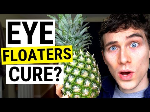 Eye Floaters No More! New (Natural) Eye Floaters Treatment Research | Doctor Eye Health