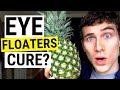 Eye Floaters No More New Natural Eye Floaters Treatment Research Doctor Eye Health