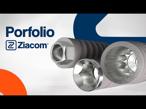 Tipos de conexión en implantes: interna, externa, cónica