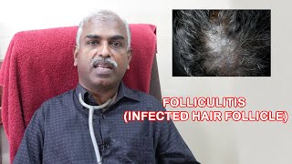 How to avoid infected hair follicles folliculitis check it out!