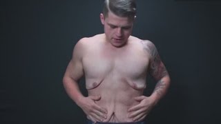 Man strips to show you loose skin after massive weight loss