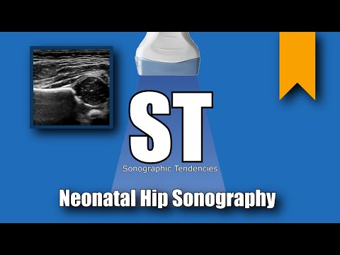 Hip Ultrasound