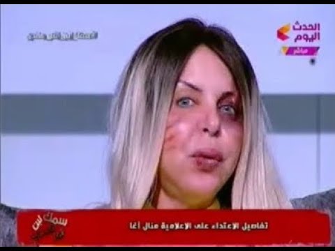 بالفيديو.. مذيعة مصرية تفجّر مفاجأة بعد ظهورها وعلى وجه