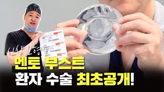 멘토부스트 리얼모델 가슴성형 후기 최.초.공.개!!